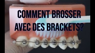 Orthodontie Comment se brosser les dents avec des brackets [upl. by Eidua]